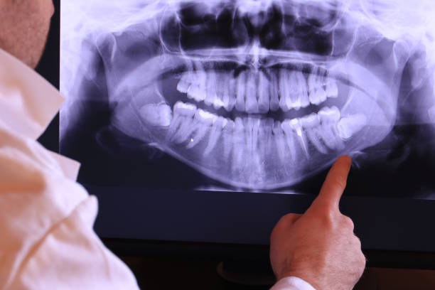Best Cosmetic Emergency Dentistry in Patterson, LA