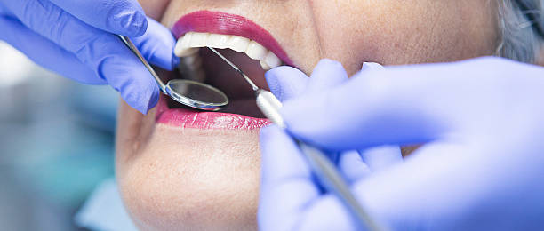 Best Urgent Care for Lost Fillings or Crowns in Patterson, LA